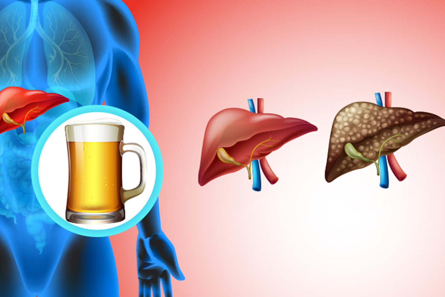 Alcohol-related liver concerns